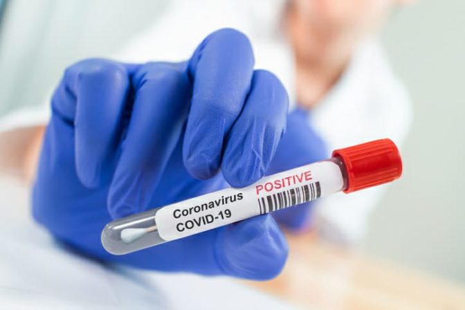 Μοριακά Τεστ κορωνοϊού (COVID-19) για όλους τους εργαζομένους του Δήμου Φαρκαδόνας