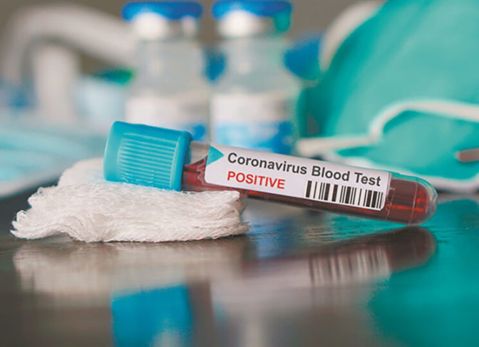 Το πρόγραμμα των rapid tests στο Δήμο Καρδίτσας