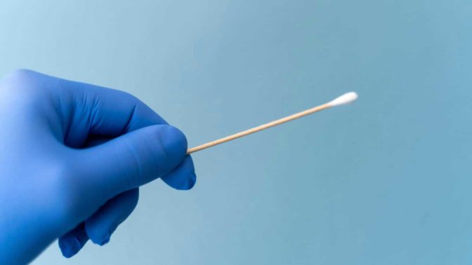 Καρδίτσα: Rapid tests στον τ. Δήμο Καλλιφωνίου