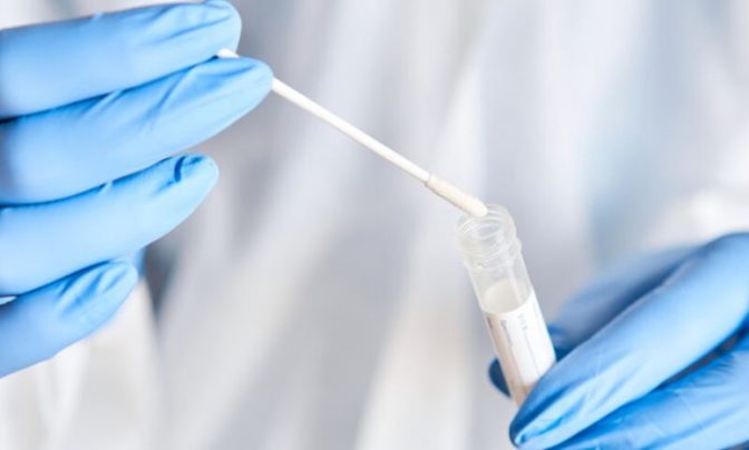 Αποτελέσματα rapid tests στις ΤΚ Ματαράγκας και Κυψέλης