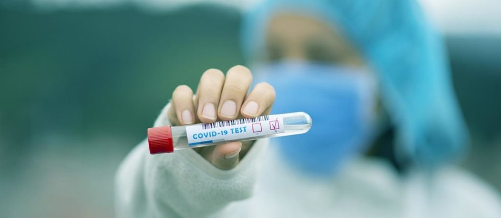 Αποτελέσματα rapid tests στη Θεσσαλία 27-07-2021