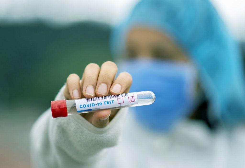 Τα αποτελέσματα των Rapid Test στη Θεσσαλία 8/09/2021