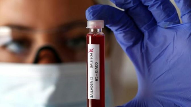 Εξέλιξη Πανδημίας στα Τρίκαλα: Στην ίδια Τραγωδία Θεατές;