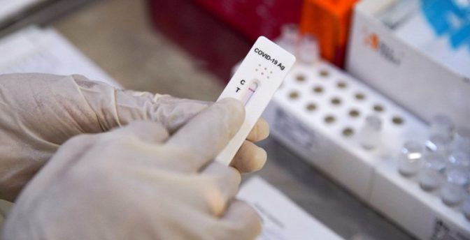 Αποτελέσματα μαζικής δειγματοληψίας (rapid tests) στη Θεσσαλία 21/01/2022