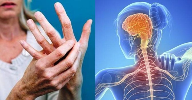 Διήμερο εκδηλώσεων για τη Σκλήρυνση κατά Πλάκας στα Τρίκαλα