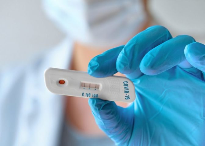 Το πρόγραμμα των rapid tests στη Θεσσαλία αύριο Τρίτη 23/8