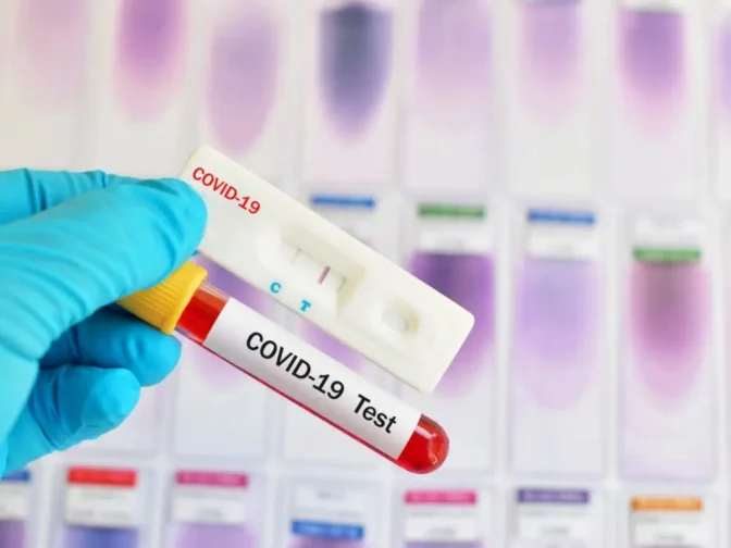 Τα αποτελέσματα των rapid tests στη Θεσσαλία 19/8