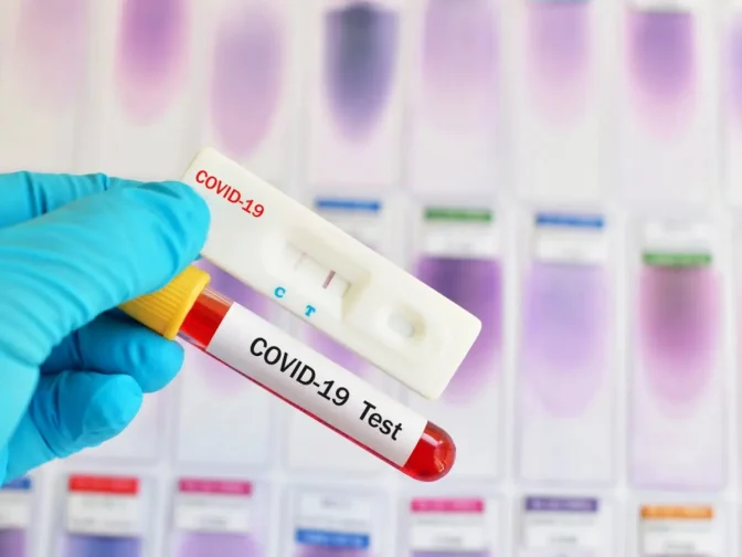 Τα αποτελέσματα των rapid tests στη Θεσσαλία 22/10
