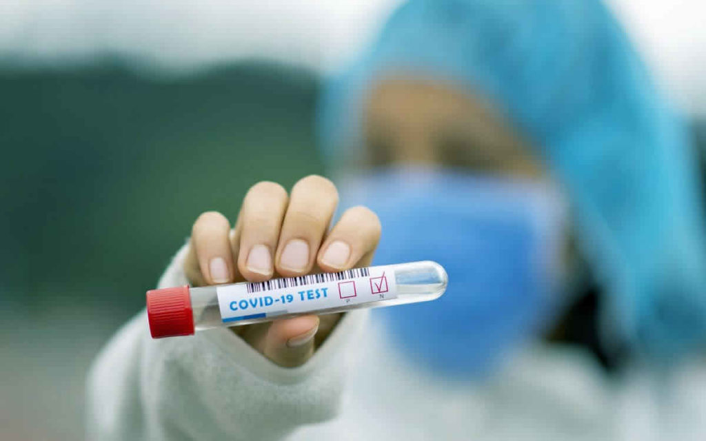 Τα αποτελέσματα των rapid tests στη Θεσσαλία 14/10