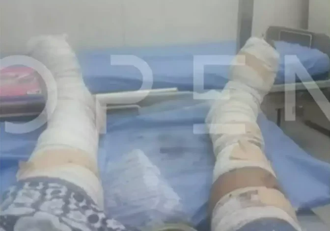 Σουδάν: Φωτογραφία ντοκουμέντο από τα τραύματα του Έλληνα που χτυπήθηκε από ρουκέτα