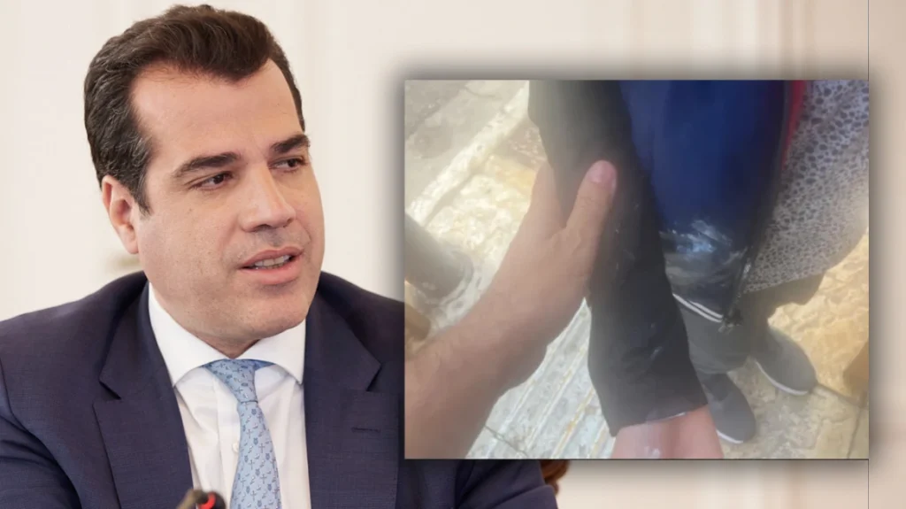 Πλεύρης: Με οίδημα στο μάτι από την επίθεση