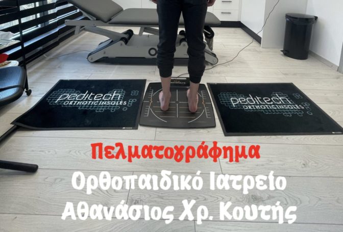 Όλα όσα θέλετε να ξέρετε για το πελματογράφημα 