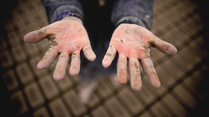 Τάσος Τσιαπλές: Το αίσχος της παιδικής εργασίας, δεν θα εκλείψει με ευχολόγια