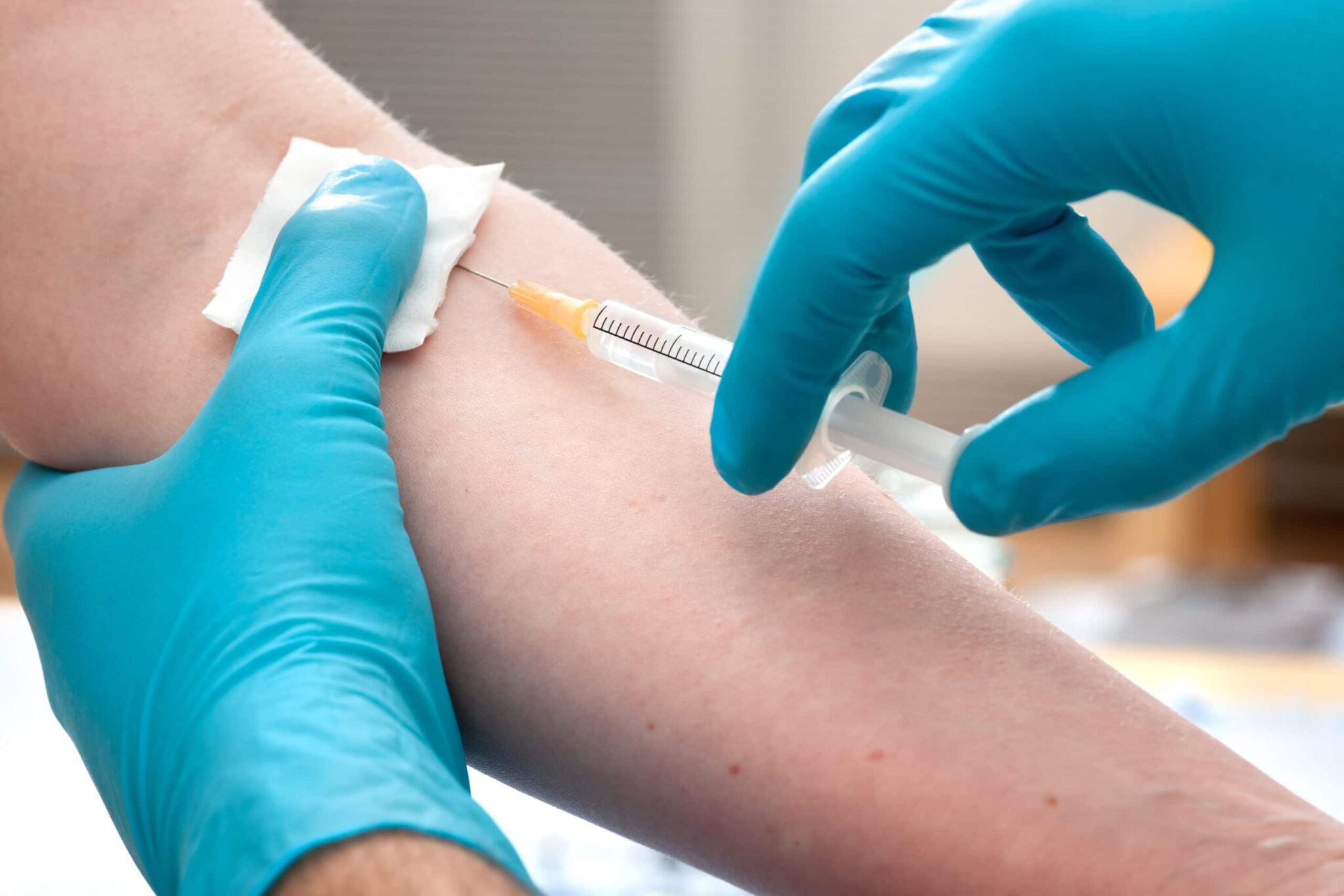 Δωρεάν test mantoux στο Κέντρο Υγείας Καλαμπάκας
