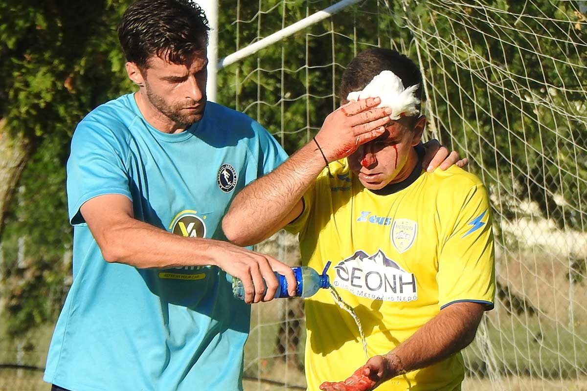 Ράμματα στο νοσοκομείο για Πάτα και Μπαούτη μετά από σύγκρουση στο φιλικό Δήμητρα–Μετέωρα